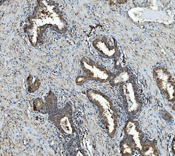 Anti-RAB1B Antibody