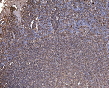 Anti-RAB1B Antibody