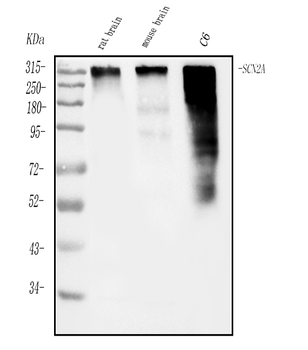 Anti-SCN2A Antibody
