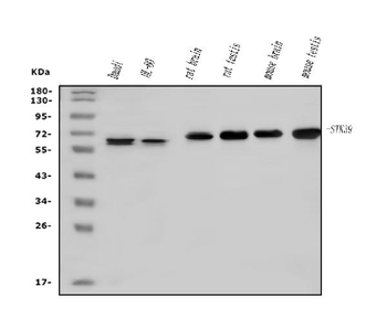 Anti-SPAK/STK39 Antibody