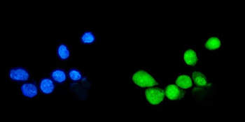 Anti-Sumo 1/SUMO1 Antibody