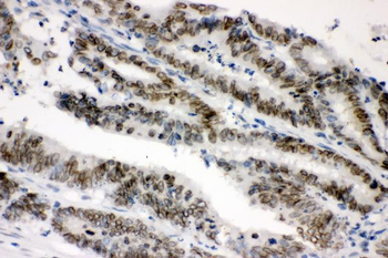 Anti-Sumo 1/SUMO1 Antibody