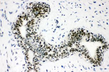Anti-Sumo 1/SUMO1 Antibody