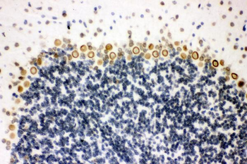 Anti-Sumo 1/SUMO1 Antibody