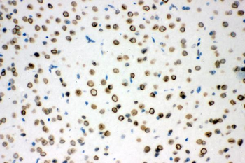Anti-Sumo 1/SUMO1 Antibody