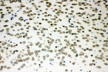 Anti-Sumo 1/SUMO1 Antibody