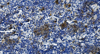 Anti-Tigit Antibody