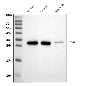 Anti-Tigit Antibody