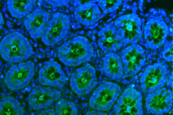 Anti-Tspan1 Antibody