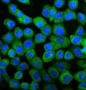 Anti-UBE2D1/2/3/4 Antibody