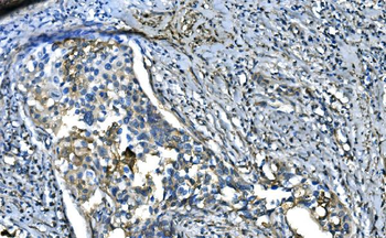 Anti-UBE2D1/2/3/4 Antibody