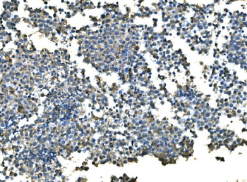 Anti-UBE2D1/2/3/4 Antibody