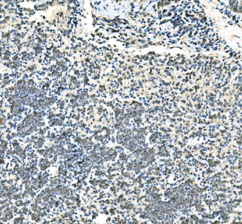 Anti-UBE2D1/2/3/4 Antibody