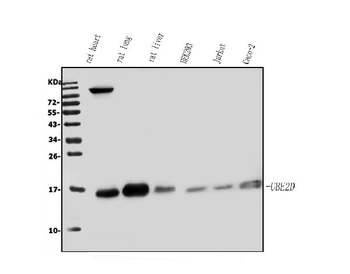 Anti-UBE2D1/2/3/4 Antibody