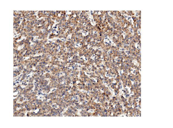 Anti-ch TOG/CKAP5 Antibody (monoclonal, 3C13)