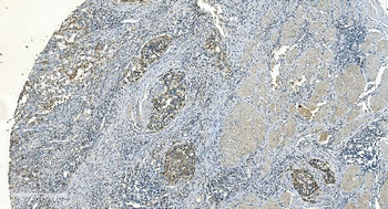Anti-IDH2 Antibody (monoclonal, 2H4)