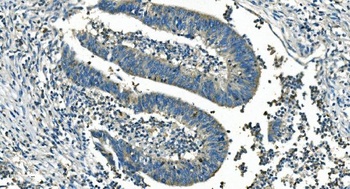 IDH2 Antibody (monoclonal, 2H4)