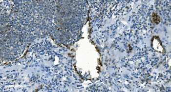 Anti-IDH2 Antibody (monoclonal, 2H4)
