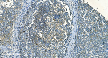 Anti-IDH2 Antibody (monoclonal, 2H4)
