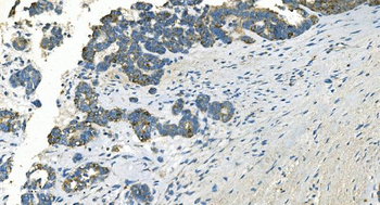 Anti-IDH2 Antibody (monoclonal, 2H4)