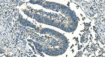 Anti-IDH2 Antibody (monoclonal, 2H4)
