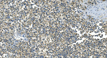 Anti-IDH2 Antibody (monoclonal, 2H4)
