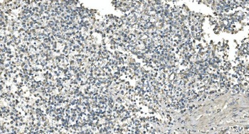 IDH2 Antibody (monoclonal, 6B13)