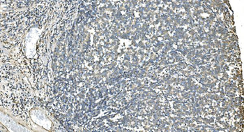 Anti-IDH2 Antibody (monoclonal, 6B13)