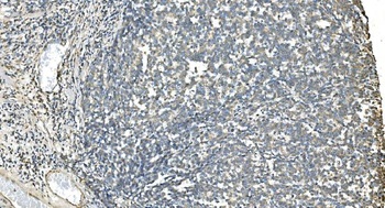 IDH2 Antibody (monoclonal, 6B13)