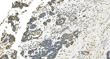 Anti-IDH2 Antibody (monoclonal, 6B13)