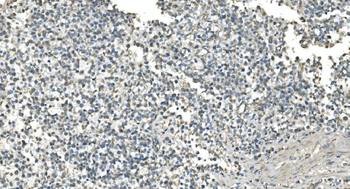 Anti-IDH2 Antibody (monoclonal, 6B13)