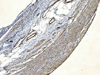 Anti-Filamin A/FLNA Antibody (monoclonal, 3F8)