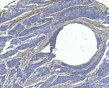 Anti-Filamin A/FLNA Antibody (monoclonal, 3F8)