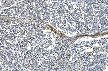 Anti-Filamin A/FLNA Antibody (monoclonal, 3F8)
