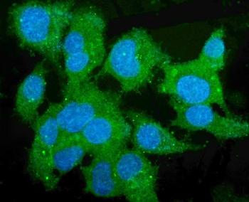 Anti-Liver Carboxylesterase 1/CES1 Antibody (monoclonal, 3F10)