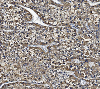 Anti-Liver Carboxylesterase 1/CES1 Antibody (monoclonal, 3F10)