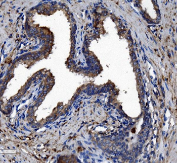 Anti-Liver Carboxylesterase 1/CES1 Antibody (monoclonal, 3F10)