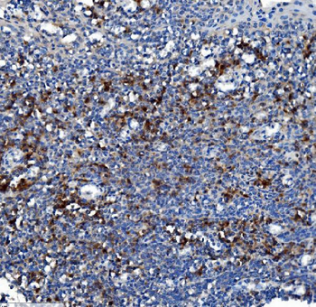 Anti-Liver Carboxylesterase 1/CES1 Antibody (monoclonal, 3F10)