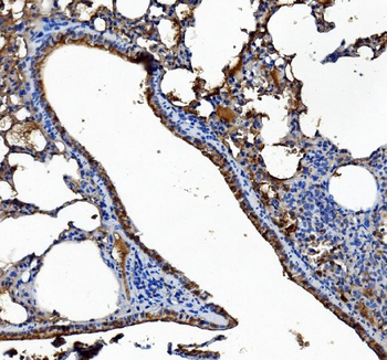 Anti-Liver Carboxylesterase 1/CES1 Antibody (monoclonal, 3F10)