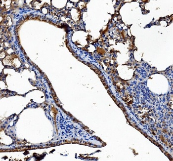 Liver Carboxylesterase 1/CES1 Antibody (monoclonal, 3F10)