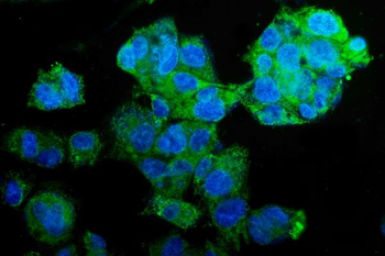 Anti-PCK2 Antibody (monoclonal, 3F7)