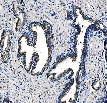 Anti-PCK2 Antibody (monoclonal, 3F7)