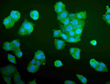 Anti-Aldolase/ALDOA Antibody (monoclonal, 6H8)
