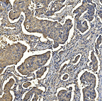 Anti-Aldolase/ALDOA Antibody (monoclonal, 6H8)