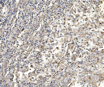 Anti-Aldolase/ALDOA Antibody (monoclonal, 6H8)