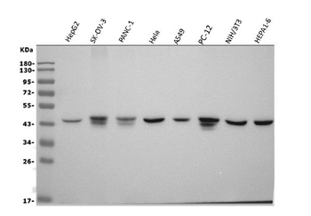 Anti-Actin/ACTA1 Antibody (monoclonal, 3H5)