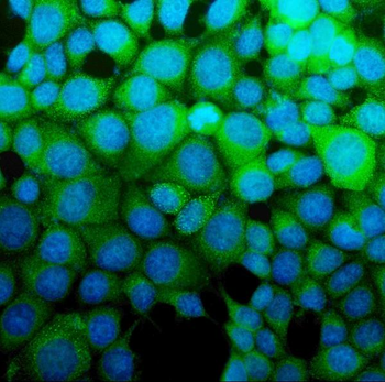 Anti-ASS1 Antibody (monoclonal, 5I5)