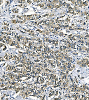 Anti-ASS1 Antibody (monoclonal, 5I5)