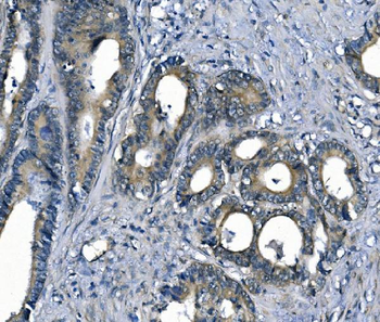 Anti-ASS1 Antibody (monoclonal, 5I5)