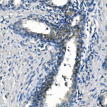 Anti-ASS1 Antibody (monoclonal, 5I5)